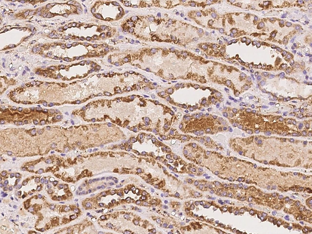 ASTL Antibody