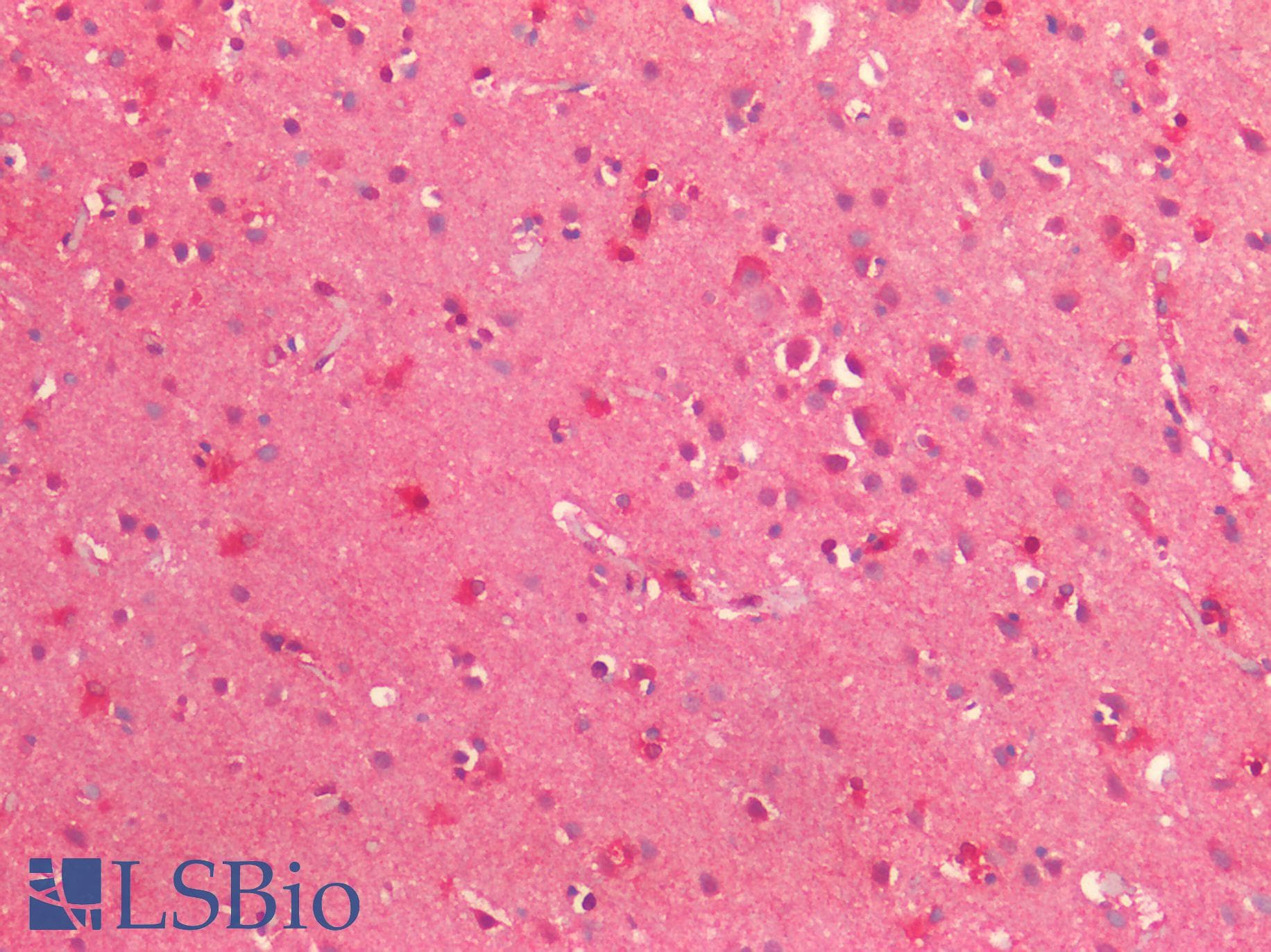PathPlus™ Polyclonal Rabbit anti-Human TTR / Transthyretin Antibody (IHC)