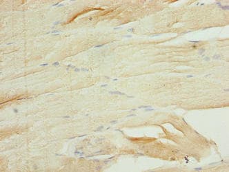 Polyclonal Rabbit anti-Human RASL10B Antibody (IHC)