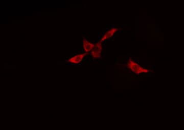 DCT / Dopachrome Tautomerase Antibody