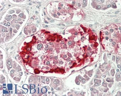 IHC-plus™ TTR / Transthyretin Antibody