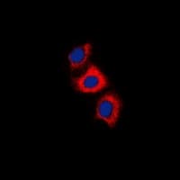 Recoverin Antibody (Internal)