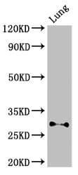 Polyclonal Rabbit anti-Human SPINT2 / HAI-2 Antibody (IF, WB)