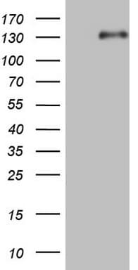LPIN1 / Lipin 1 Antibody (aa1-274, clone OTI7H6)