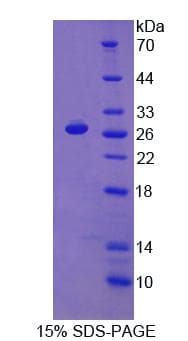 Human PRODH Protein (Recombinant His-T7)