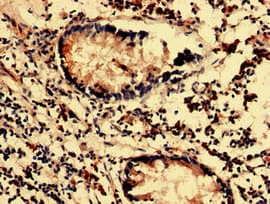 Polyclonal Rabbit anti-Human MAN2C1 Antibody