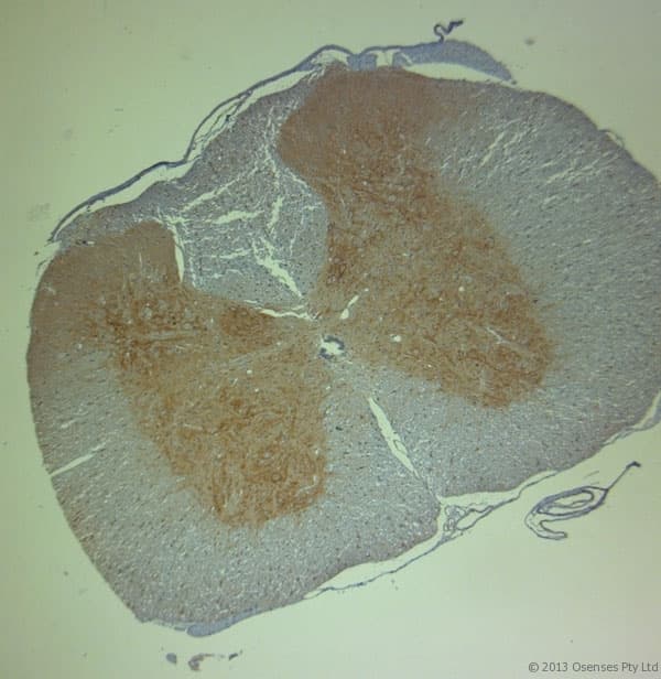 Polyclonal Rabbit anti-Human ACAN / Aggrecan Antibody (aa200-250, IHC)