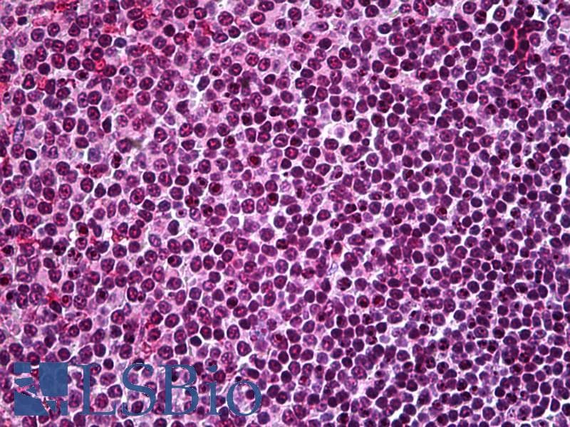 IHC-plus™ Polyclonal Rabbit anti-Human NCL / Nucleolin Antibody (aa284-709, IHC, IF, WB)