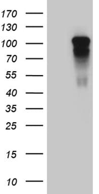 AFAP1 / AFAP Antibody (clone OTI2D11)