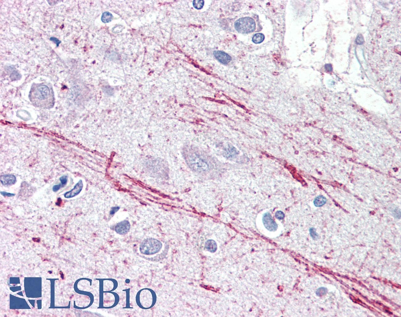 PathPlus™ IGF2 Antibody (aa81-93)