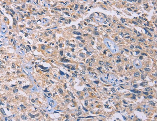 Polyclonal Rabbit anti-Human GB5 / GNB5 Antibody (IHC, WB)