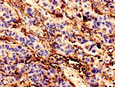 BCAT1 / ECA39 Antibody