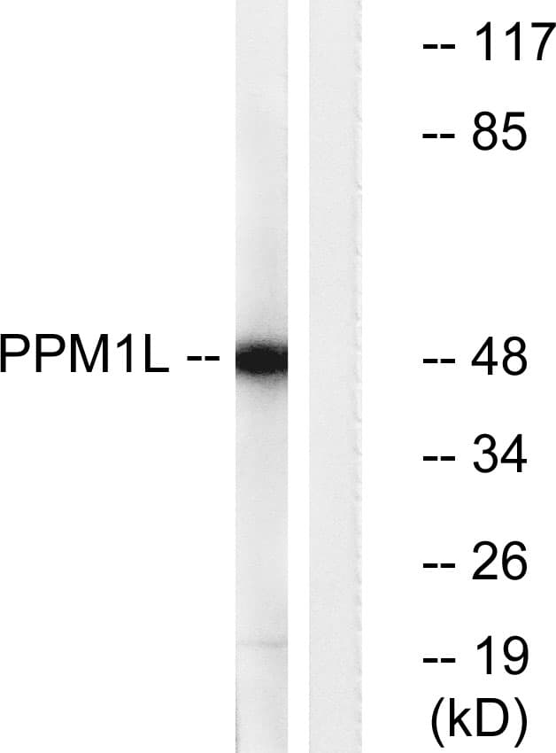 PPM1L Antibody (aa119-168)