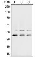 IHC-plus™ Polyclonal Rabbit anti-Human HNRPA1 / HnRNP A1 Antibody (Internal, IHC, IF, WB)