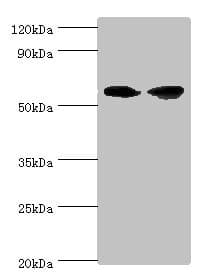 AHCYL1 / DCAL Antibody (aa31-260)
