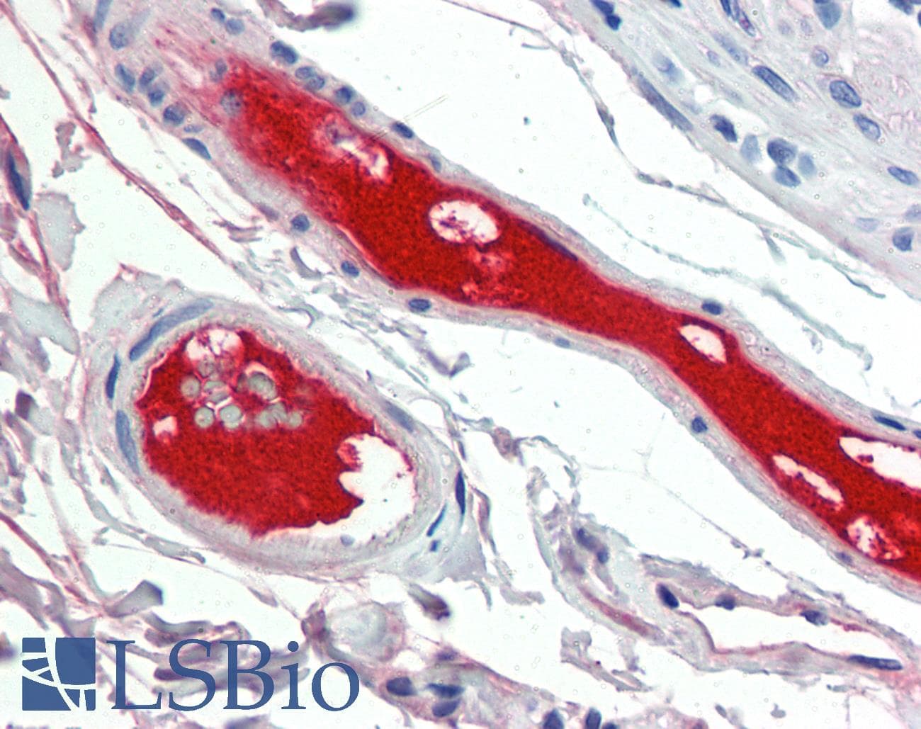 IHC-plus™ Complement C4d Antibody (Internal, clone A24-T)
