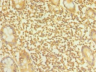 TAC1 Antibody (aa1-129)