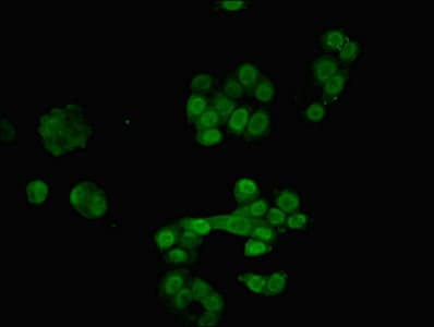 IHC-plus™ RAVER2 Antibody (aa2-691)