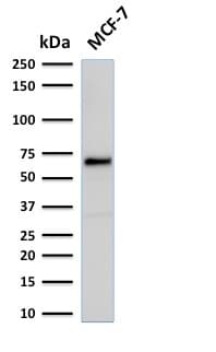 ER Alpha / Estrogen Receptor Antibody (clone rESR1/1935)