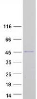 Human MBOAT7 / BB1 Protein (Recombinant Myc-DDK (Flag))