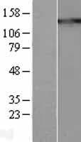 Human THBS1 / Thrombospondin-1 Protein (Over-Expression Lysate Myc-DDK (Flag))