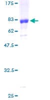 Human ILKAP Protein (Recombinant GST)