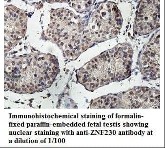 ZNF230 Antibody (aa66-294)