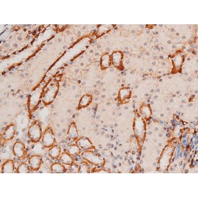 MAPK8 / JNK1 Antibody (phospho-Thr183,pTyr185)