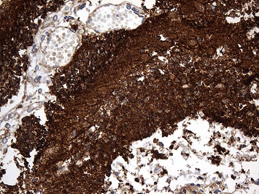 Monoclonal Mouse anti-Human DBN1 / Drebrin Antibody (clone OTI4B1, aa2-240, IHC, WB)
