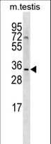 SHARPIN Antibody (aa240-269)