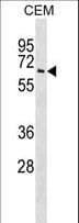 TPP1 / CLN2 Antibody (aa6-34)