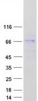 Human FBXL18 Protein (Recombinant Myc-DDK (Flag))