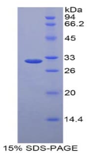 Human LRP5L Protein (Recombinant His-T7)