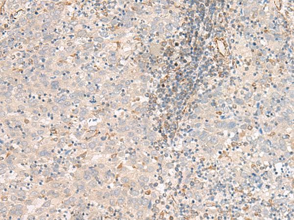 FER Antibody
