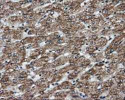APP / Beta Amyloid Precursor Antibody (clone OTI2B10)