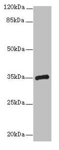 CPXCR1 / CT77 Antibody