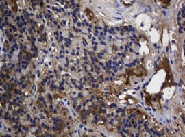 TSC22D1 / TSC22 Antibody (clone OTI4A11, Carrier-free)