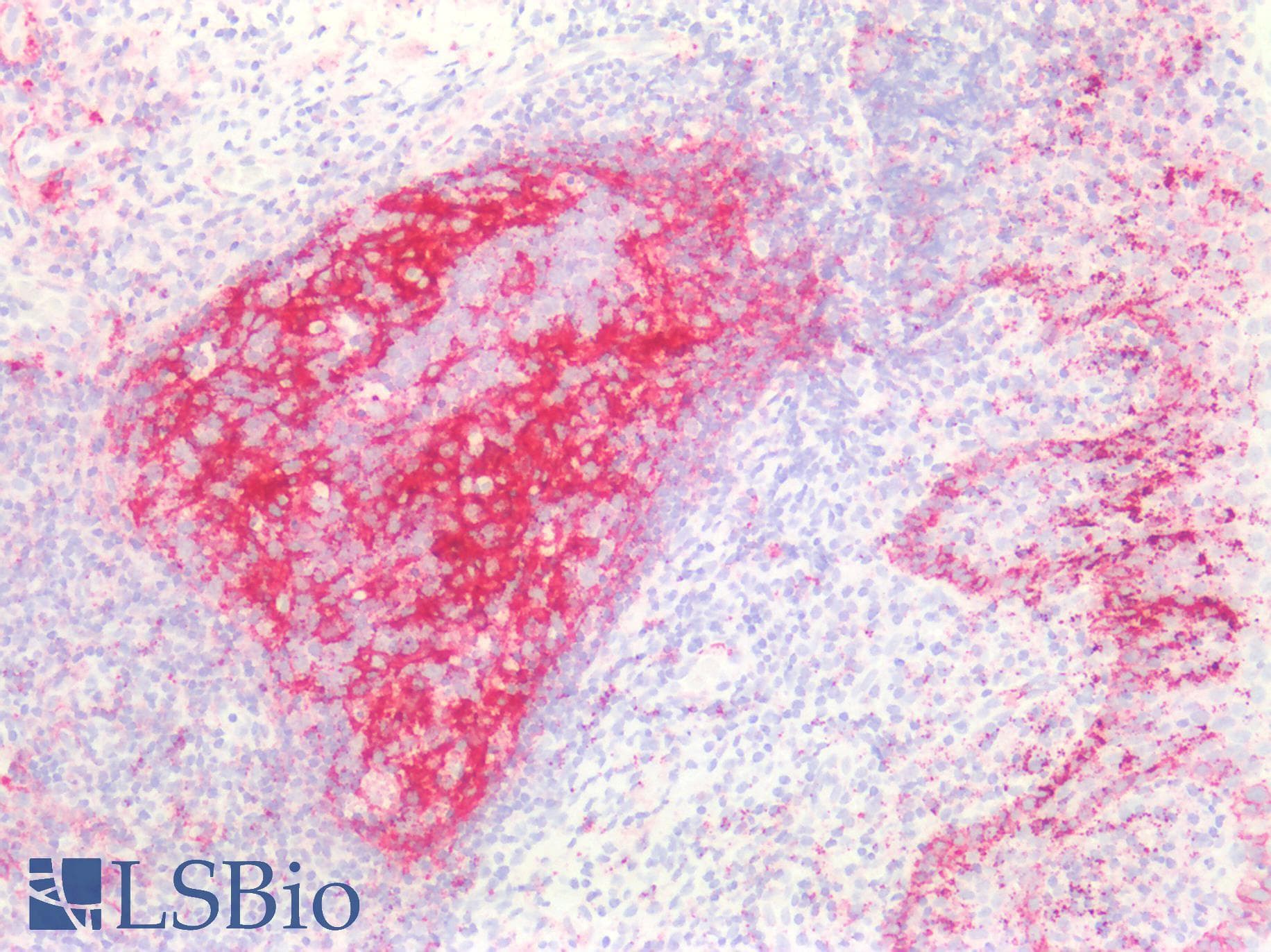 PathPlus™ NGFR / CD271 / TNR16 Antibody
