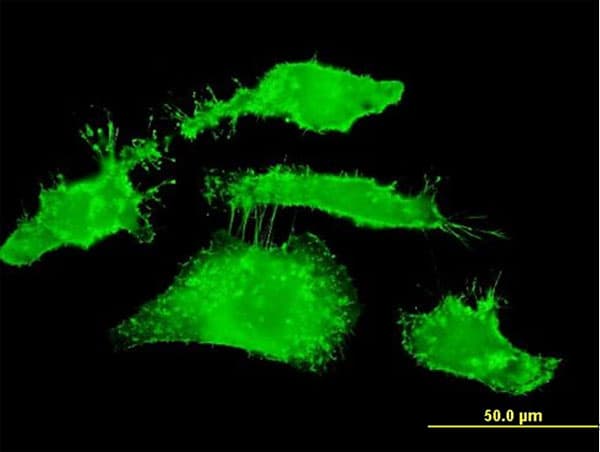 Monoclonal Mouse anti-Human RDX / Radixin Antibody (clone 1E12, IF, WB)
