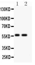 Polyclonal Rabbit anti-Human PIAS4 / PIASY Antibody (aa295-310, WB)