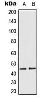 Polyclonal Rabbit anti-Human MEK1 + MEK2 Antibody (phospho-Ser218/Ser222, IHC, WB)