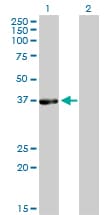 RD / PHYH Antibody (clone 1F2-5B9)