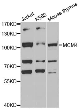 Polyclonal Rabbit anti-Human MCM4 Antibody (IHC, WB)