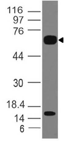 IL1RL2 Antibody