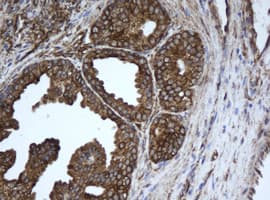 EPHX1 / Epoxide Hydrolase 1 Antibody (aa21-230, clone OTI3F11, Carrier-free)