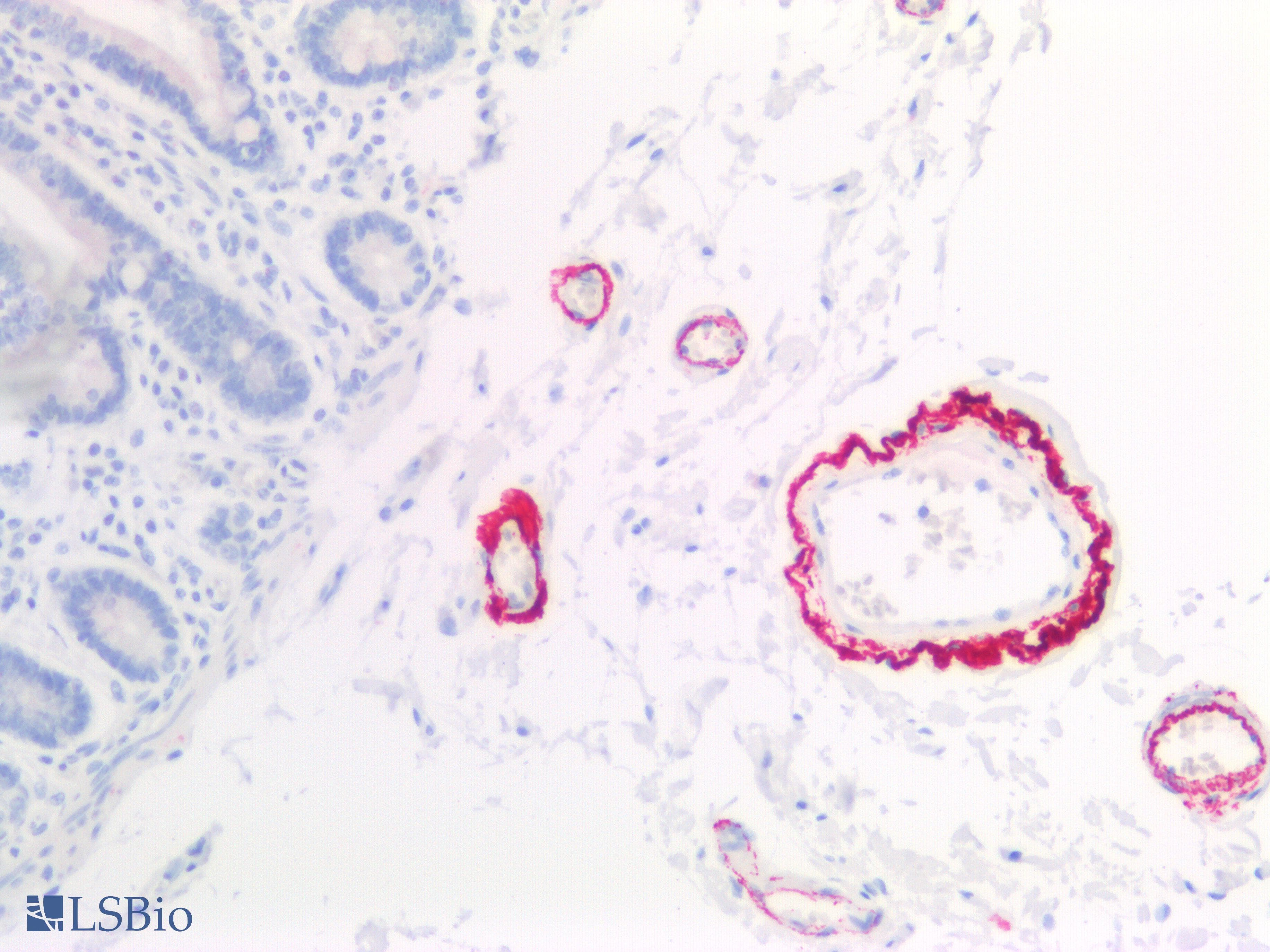 PathPlus™ COL8A1 / Collagen VIII Alpha 1 Antibody (aa583-743)