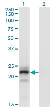 CGB / hCG Beta Antibody (clone 3B4)