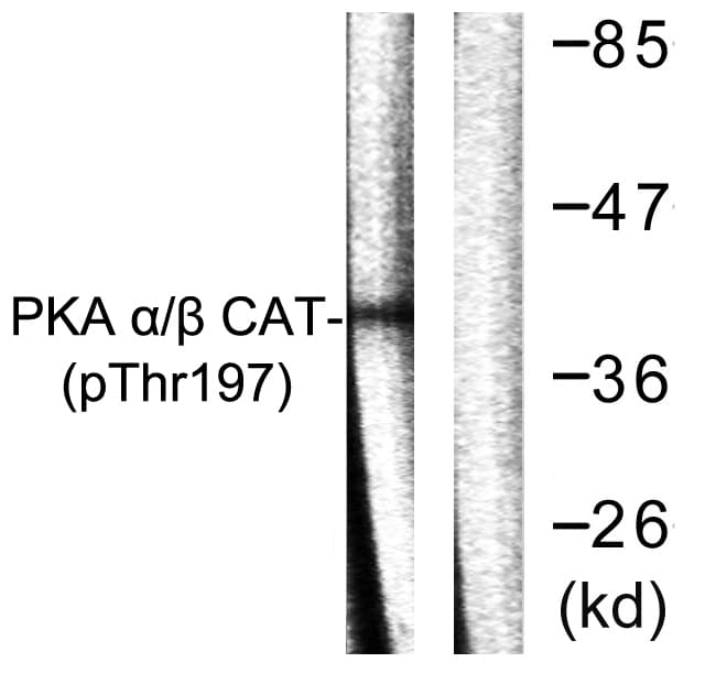 PRKACA + PRKACB Antibody (phospho-Thr197)