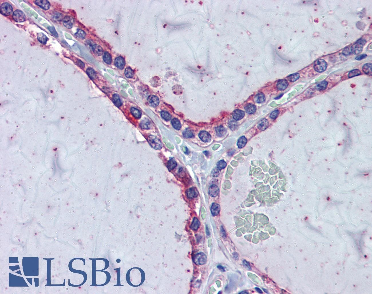 RAB6KIFL / KIF20A Antibody (C-Terminus)