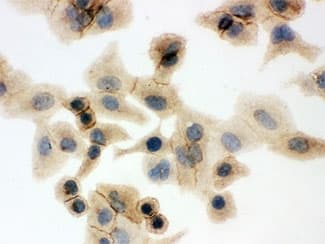 SLC2A1 / GLUT-1 Antibody (aa92-492)